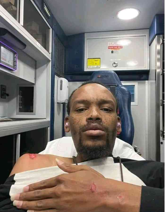 Nota Baloyi Reacts After Being Hit By A Car In America 